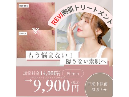 リーベ(Liebe×RNJ)の写真