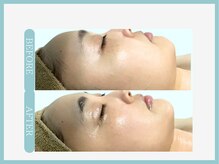 アコガレコガオ 弘前店/