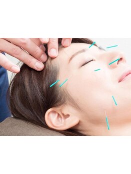 鍼灸施術を受けたい