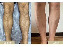 シャイン(SHINE)/