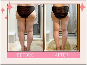 ヨサパーク ミルレ(YOSAPARK Milure)/