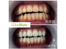 ルブラン 奈良店(Le Blanc)/春休み中にオススメのメニュー