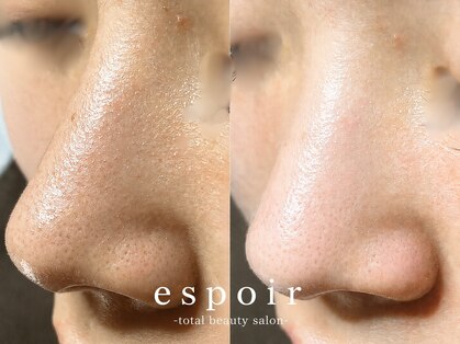 エスポア(espoir)の写真