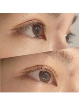 アリゼ(Alize)/ラッシュリフト