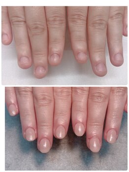 スマイルニコ(smile nico)/深爪矯正　長さ出し有ワンカラー