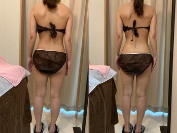 ハッテンビューティーパーク 神戸店(Hatten Beauty Park 810)/モニター様ビフォーアフター