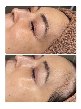 ルアナ(LUANA)/【次世代ピーリング】ララピール