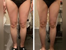 プライベートエステティックサロン クール(Coeur)/【脂肪燃焼/脚デトックス】