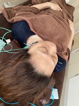 ハリファ鍼灸院 横浜関内院(HariFa鍼灸院)/美容鍼施術/美容鍼