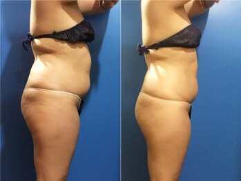 ソイズ 上中居店(SOIS)/インド痩身