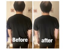 トトノウ 南口店(totonou)/Before after (13)