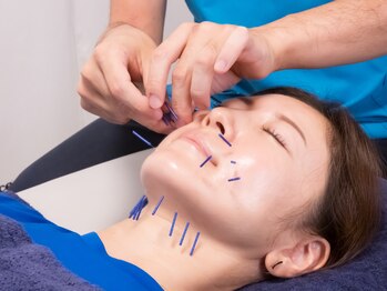 グッドバランス 学芸大学(Good Balance)/【メニュー】美容鍼+パルス電気