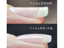 フローラ