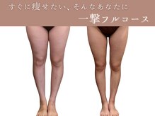 ベベティー(BEBETIE)/短期痩せしたい方向け☆一撃痩せ