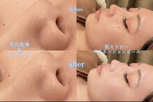 アクトベレッザ(Act BELLEZZA)