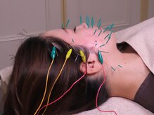 三軒茶屋鍼灸治療院/美容鍼