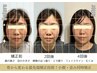【9月限定♪】骨格から整える本格小顔矯正☆/エラ張り・左右差・首肩こり