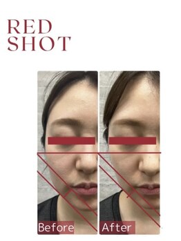 ピュールマロン ムッシュタロウ 桑名店(Pure Marron M.Taro)/【RED　SHOT】ビフォーアフター