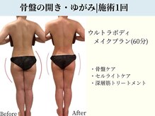 京都フォーエイチ(京都4H)/骨盤ケア|60分|施術1回