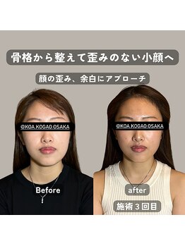 コア 中目黒店(Koa)/お客様ビフォーアフター!!