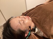 ハリファ鍼灸院 横浜関内院(HariFa鍼灸院)/美容鍼