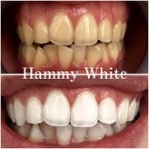 ハミーホワイト(Hammy White)