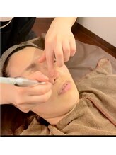 ロゼッティ(ROSETTY)/毛穴洗浄☆吸引中☆