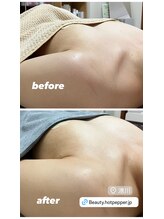 ノンノン(Non Non)/１回目