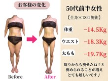 ベルホワイト(Belle White)/【50代前半/3ヶ月の変化】