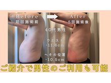 レパード/5回の施術でお腹合計22.1cm減！