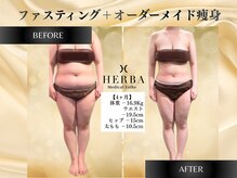 ヘルバ(HERBA)の雰囲気（【大人気オーダーメイド痩身】人気の秘訣は口コミをご覧ください）