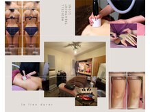 ルリアンデュレ(le lien durer)