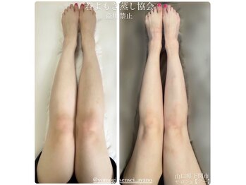 リレフー(Relafy)/★痩身★