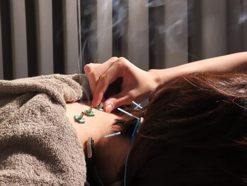 オウユ(OUYU)の写真/鍼施術で首肩こり、腰痛、眼精疲労もスッキリ♪表情筋&血流ケアで年齢肌悩みをケアできる美容鍼も人気！
