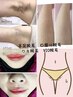 【新規限定】美肌脱毛、介護VIO脱毛 500円引き