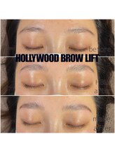 カイリ(Kaire)/ハリウッドブロウリフト