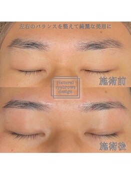 アイブロウマン(i Browman)/ビジネスマンは眉毛が違う　