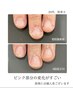 【最強のネイルケア】地爪育成・深爪改善ケアコース☆全8回　¥55000