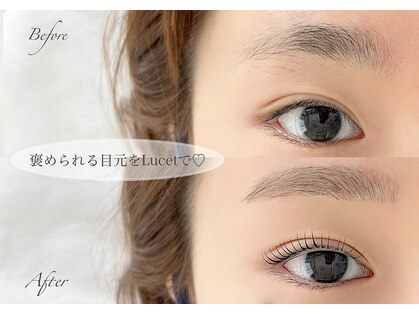 ルシェット(Lucet)の写真