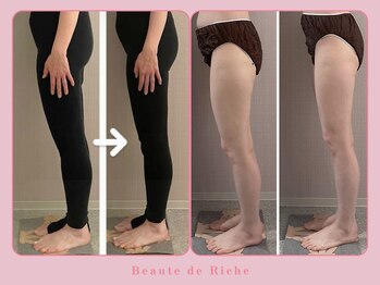 ボーテドリッシュ(Beaute de Riche)/