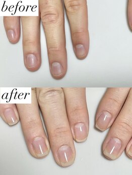 ニコワイズネイル(Nico Y's Nail)/自爪育成