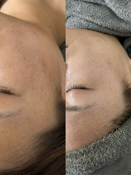 スムー 金沢小橋町店(Smoo)/細胞ケア