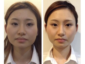 リバース(Re birth)/ビフォーアフター