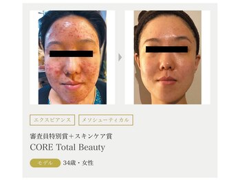 まりも化粧品店/ホワイトスノーピール