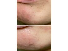 サイ(Sai)/before⇒after