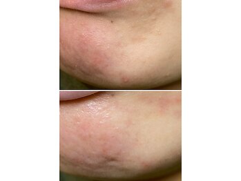 サイ(Sai)/before⇒after