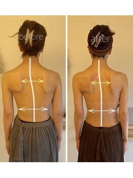 パル コルギサロン(Pal. Korugi salon)/コルギビフォーアフター