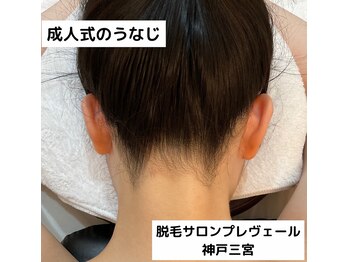 プレヴェール 神戸三宮/成人式のうなじ脱毛