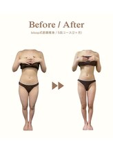 ビループ(biloop)/浮腫知らずの身体に。