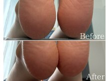 カシェット 広島店(Cachette)/30代女性☆足裏角質ケア60分